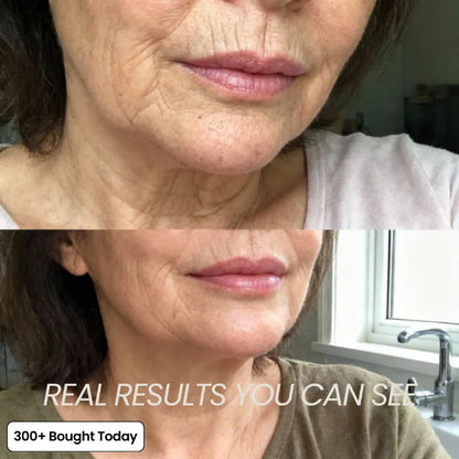 PDRN Collagen Balm 5% Volufiline