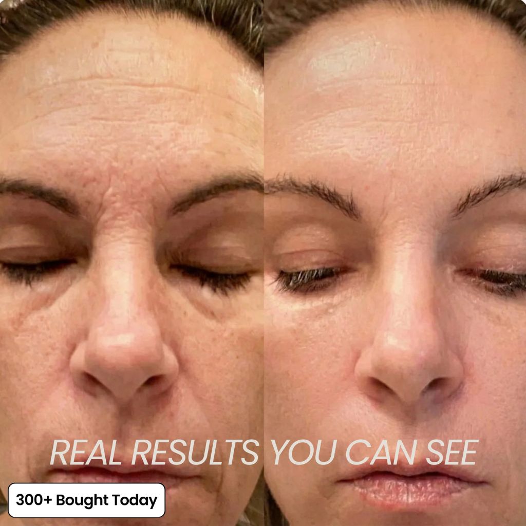 PDRN Collagen Balm 5% Volufiline