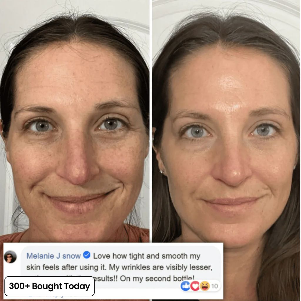 PDRN Collagen Balm 5% Volufiline